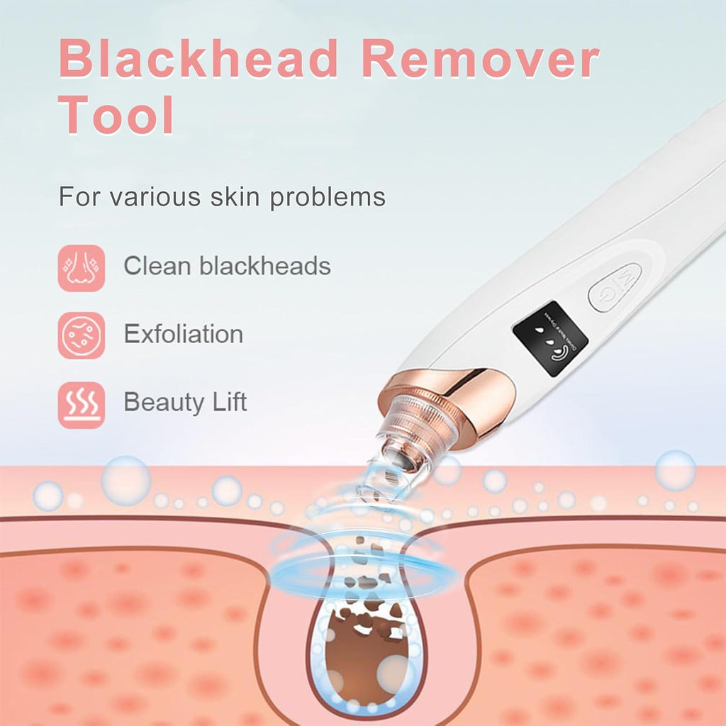 Pore Vacuum Blackhead Remover with 3 Adjustable Suction Levels, USB Rechargeable, 5 Replaceable Heads for Face Deep Cleansing, Includes Blackhead Spatula for Women & Men