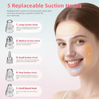 Pore Vacuum Blackhead Remover with 3 Adjustable Suction Levels, USB Rechargeable, 5 Replaceable Heads for Face Deep Cleansing, Includes Blackhead Spatula for Women & Men