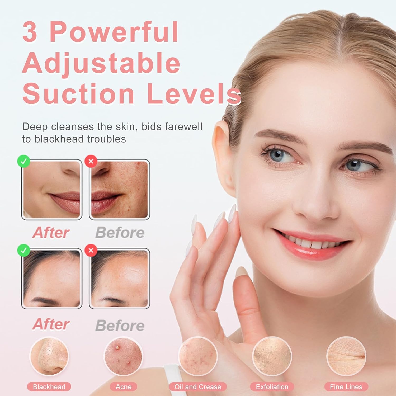 Pore Vacuum Blackhead Remover with 3 Adjustable Suction Levels, USB Rechargeable, 5 Replaceable Heads for Face Deep Cleansing, Includes Blackhead Spatula for Women & Men