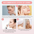 Pore Vacuum Blackhead Remover with 3 Adjustable Suction Levels, USB Rechargeable, 5 Replaceable Heads for Face Deep Cleansing, Includes Blackhead Spatula for Women & Men